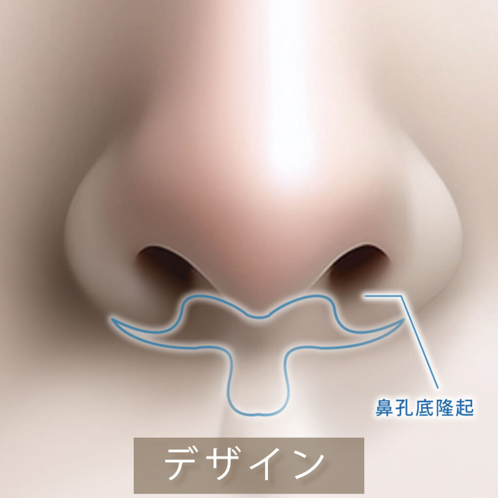 人中短縮手術の切開ラインのデザイン