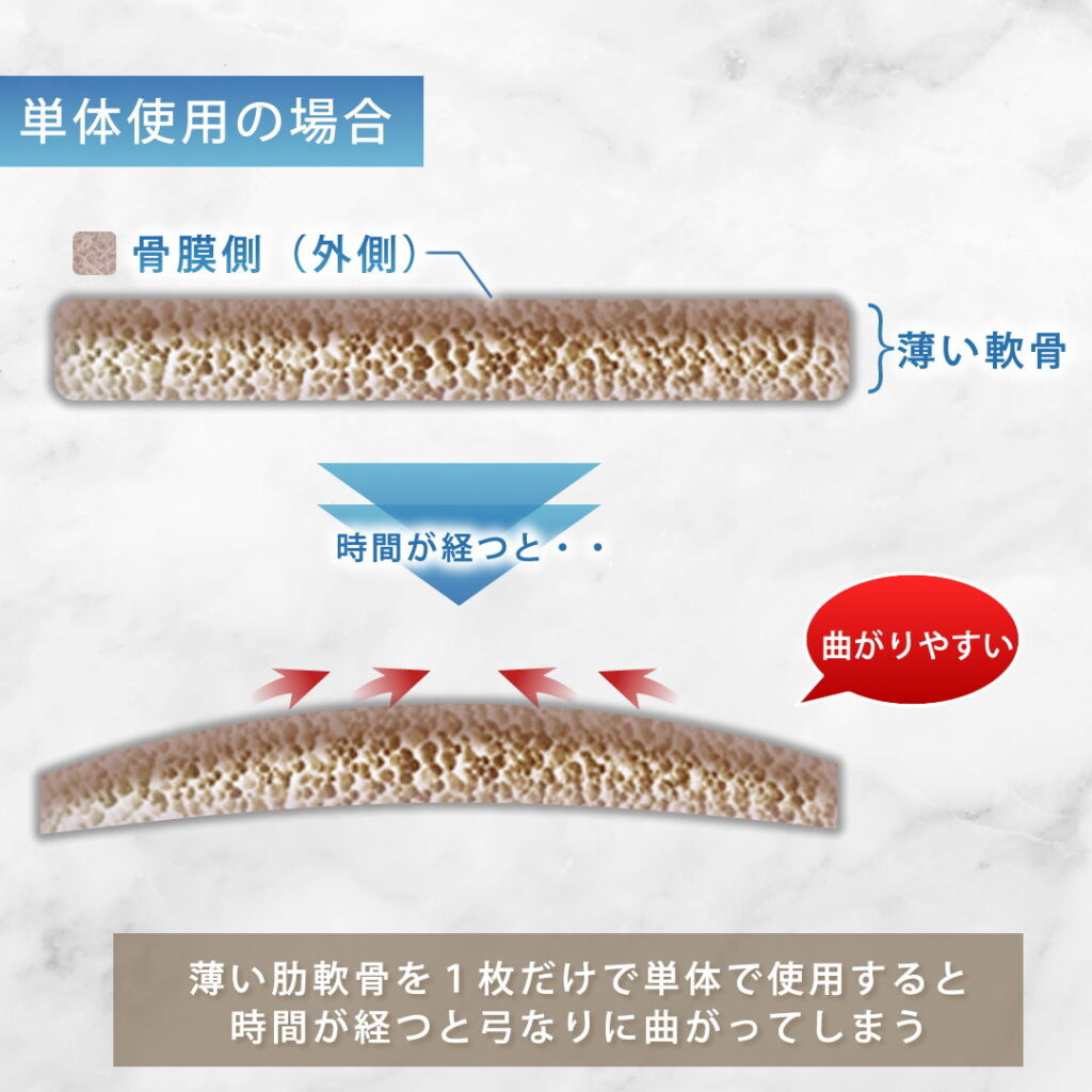 肋軟骨の単体使用の場合の図解