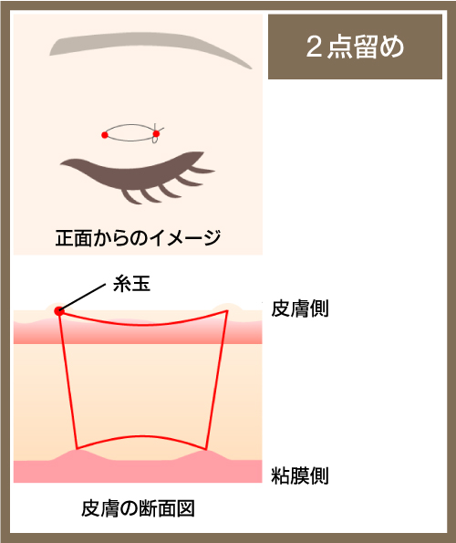 ２点留めの図解