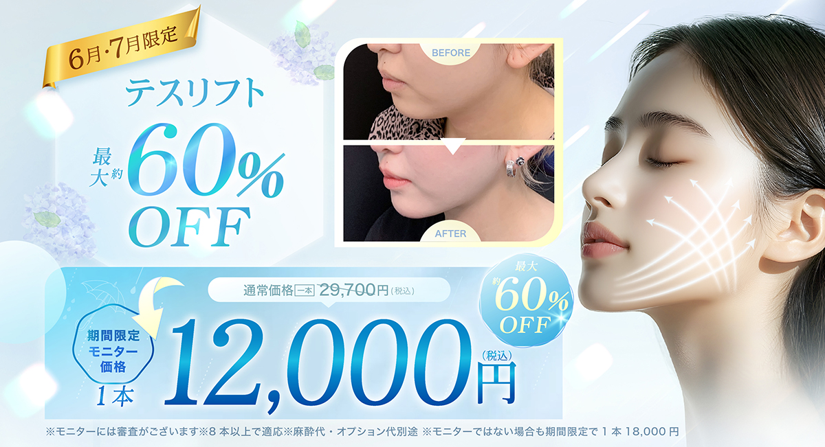 糸リフトのモニターキャンペーン