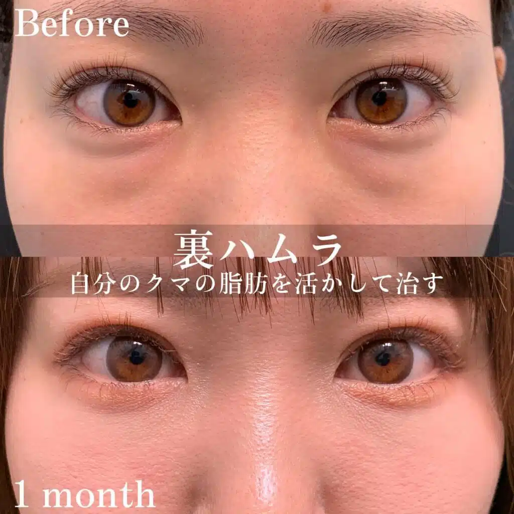 裏ハムラ　福岡