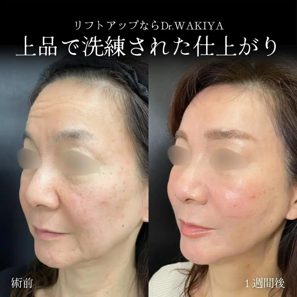 上品で洗練された仕上がり　福岡