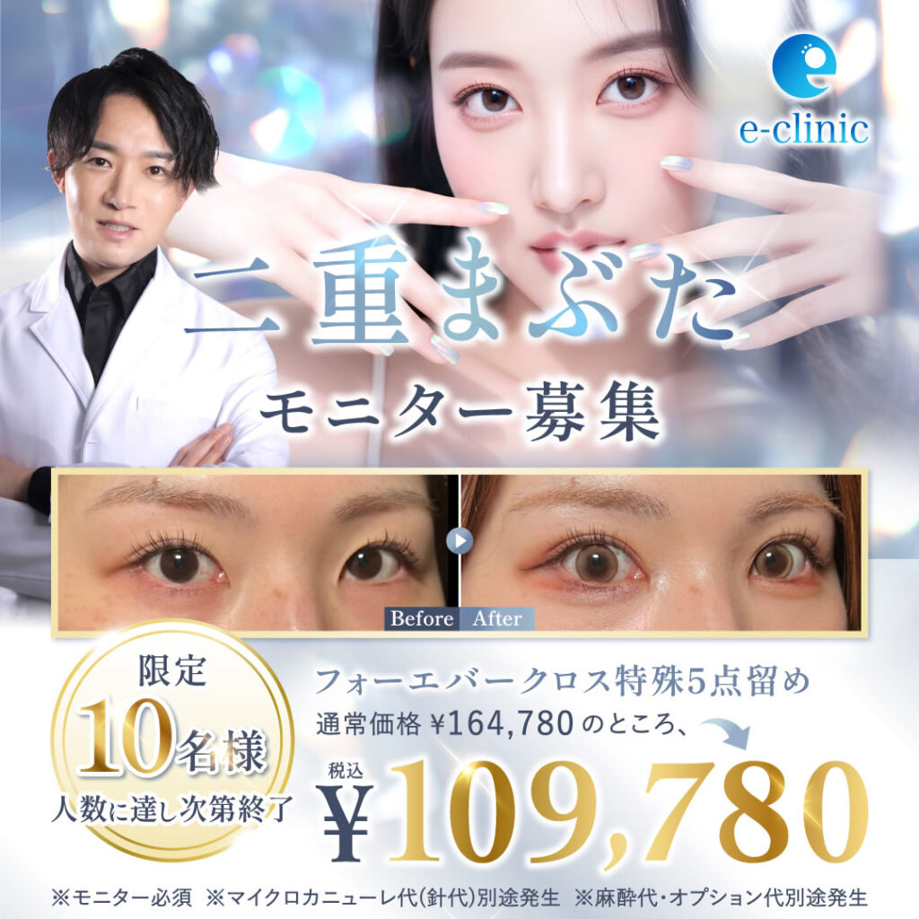 福岡院の二重埋没法のバナー