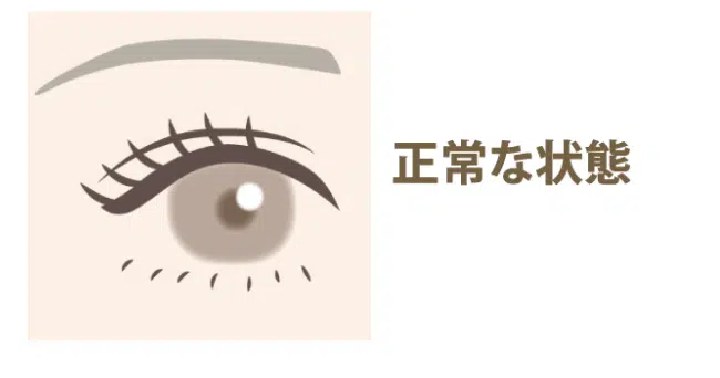 正常な目 福岡