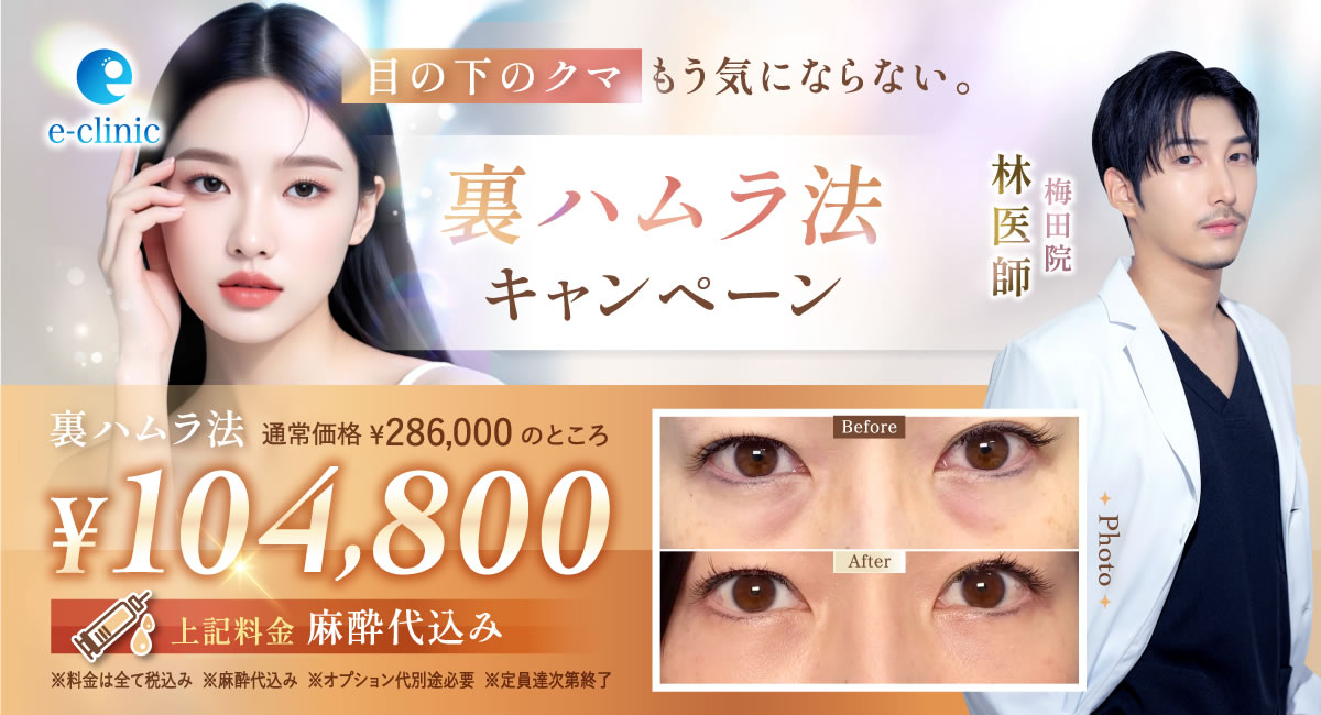 林医師の裏ハムラ法のキャンペーンバナー