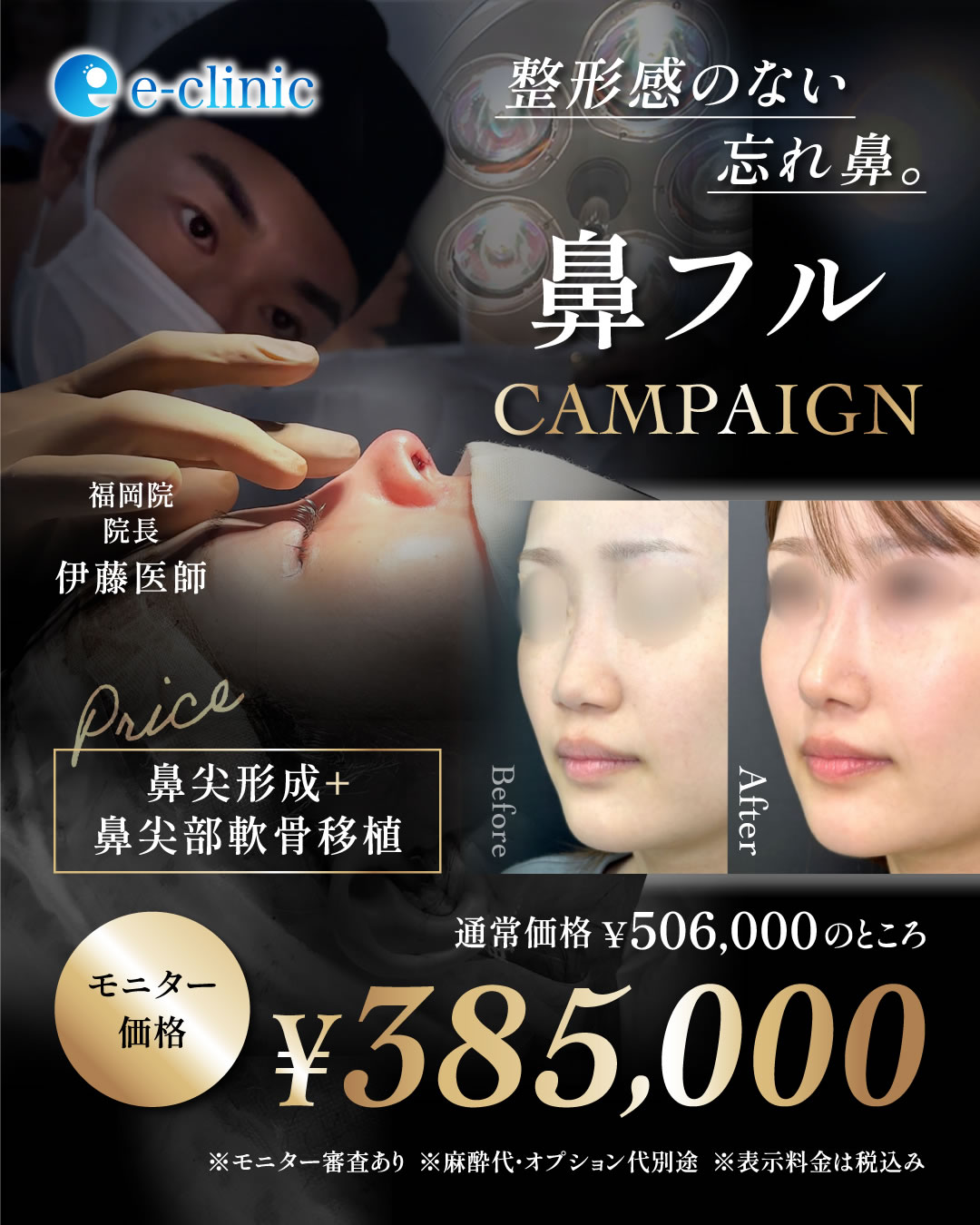 スマフォ用の福岡の鼻フルのバナー