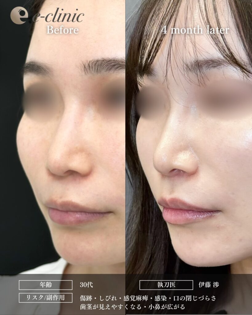 人中短縮の症例写真 (32)