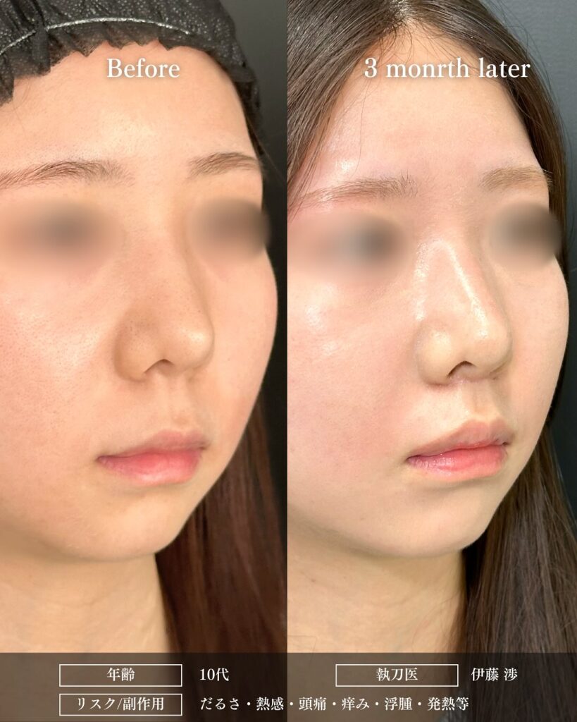 人中短縮の症例写真 (23)