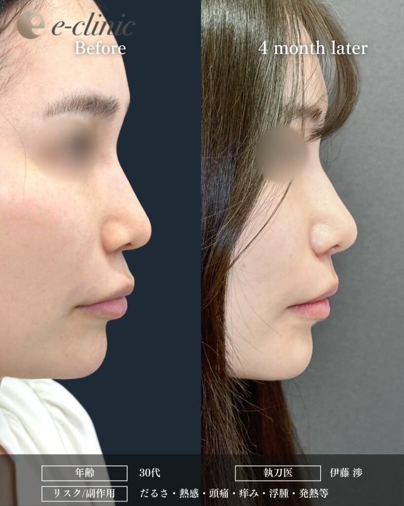 人中短縮の症例写真 (29)