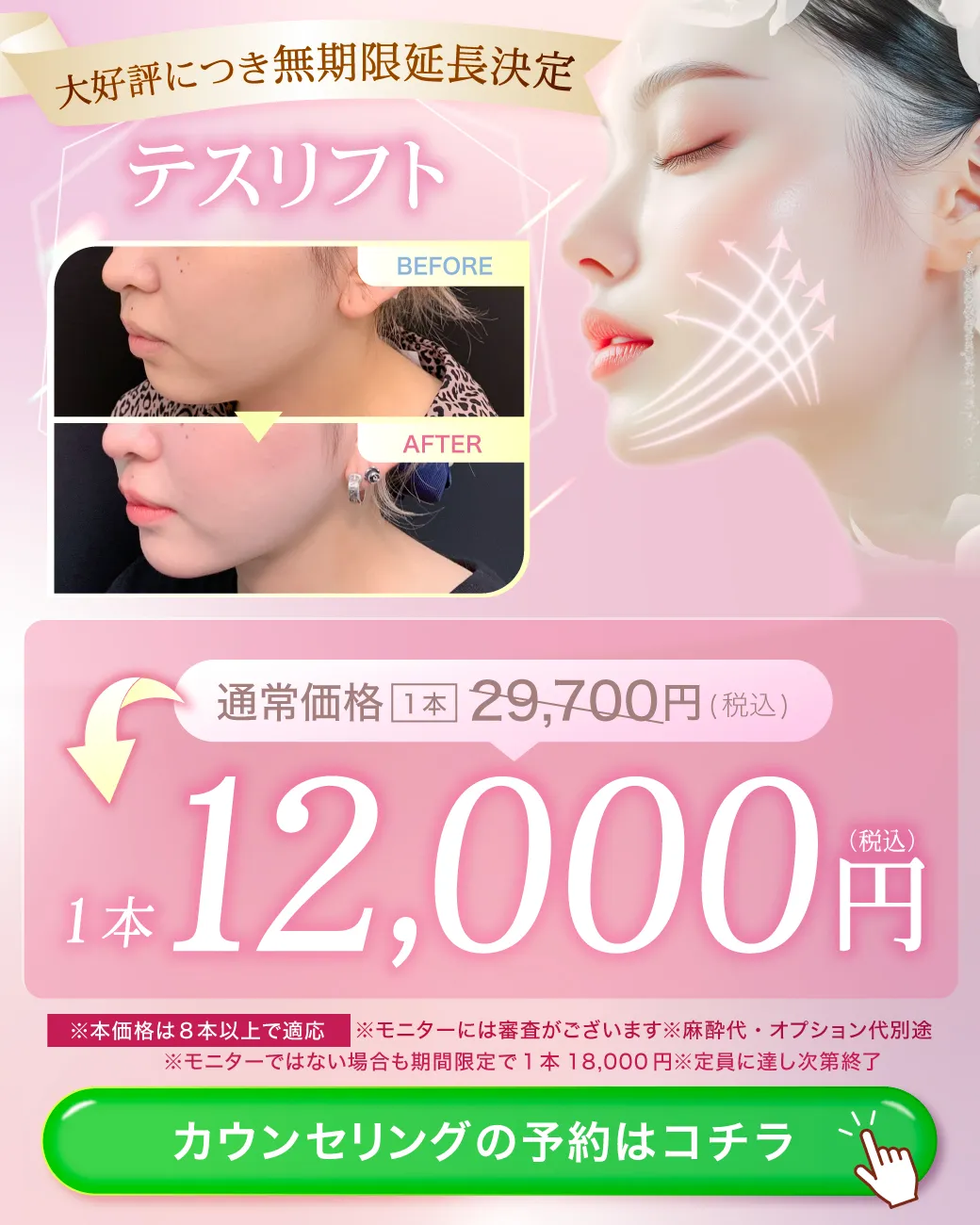 閑散期テスリフトCP