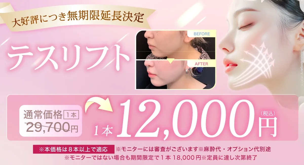 閑散期テスリフトCP