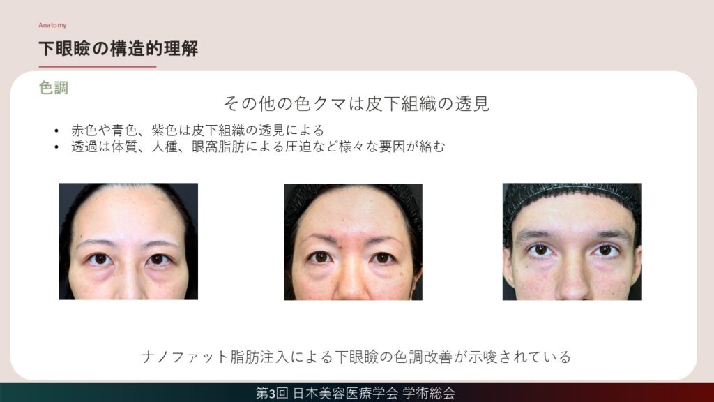 14_下眼瞼の構造的理解(色調）